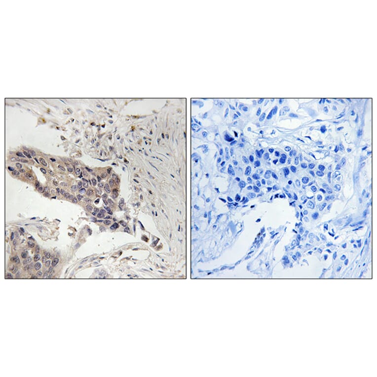 Immunohistochemistry - Anti-SLP-76 Antibody (B8209) - Antibodies.com