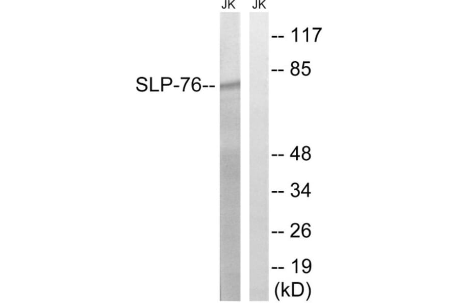 Western Blot - Anti-SLP-76 Antibody (B8209) - Antibodies.com