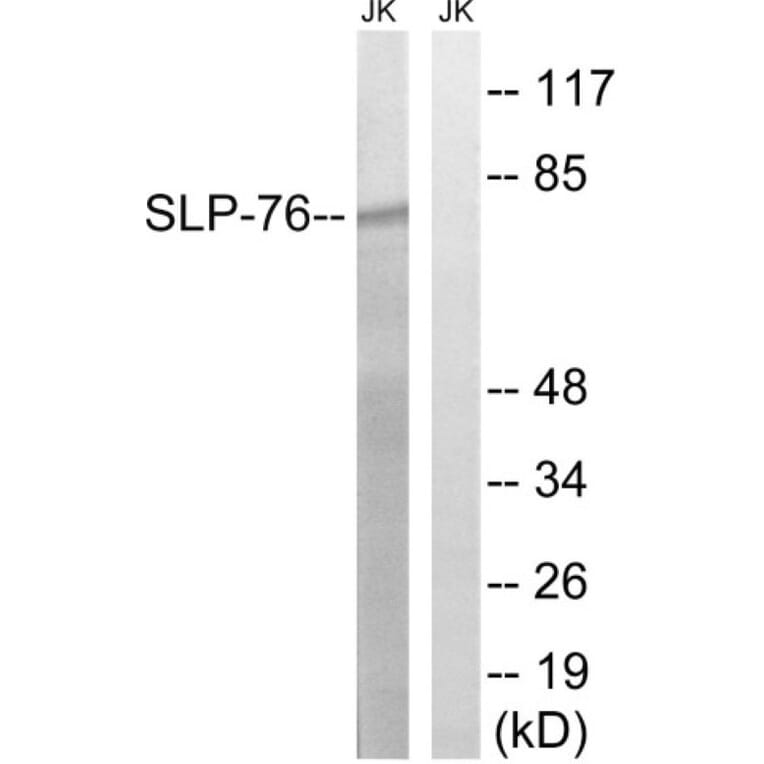 Western Blot - Anti-SLP-76 Antibody (B8209) - Antibodies.com