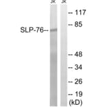 Western Blot - Anti-SLP-76 Antibody (B8209) - Antibodies.com