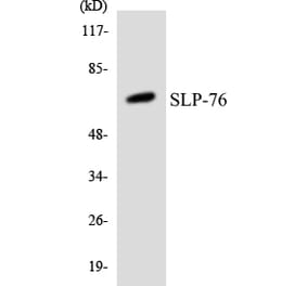 Western Blot - Anti-SLP-76 Antibody (R12-3542) - Antibodies.com