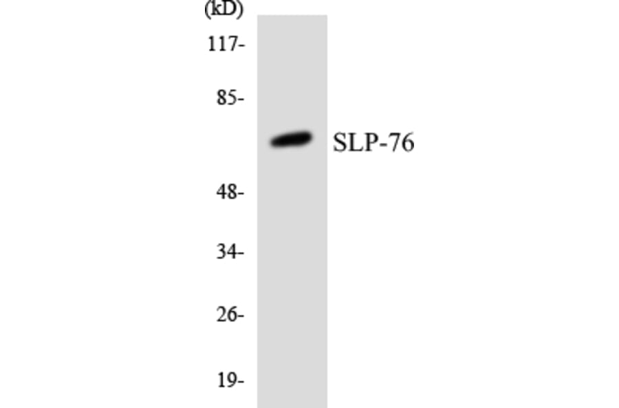Western Blot - Anti-SLP-76 Antibody (R12-3542) - Antibodies.com