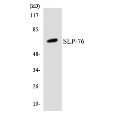 Western Blot - Anti-SLP-76 Antibody (R12-3542) - Antibodies.com