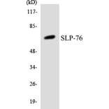 Western Blot - Anti-SLP-76 Antibody (R12-3542) - Antibodies.com