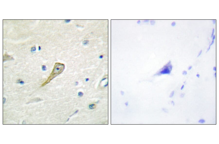 Immunohistochemistry - Anti-SEMA4A Antibody (C11691) - Antibodies.com