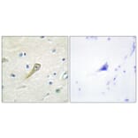 Immunohistochemistry - Anti-SEMA4A Antibody (C11691) - Antibodies.com