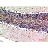 Immunohistochemistry - Anti-S100A1 Antibody (C30746) - Antibodies.com