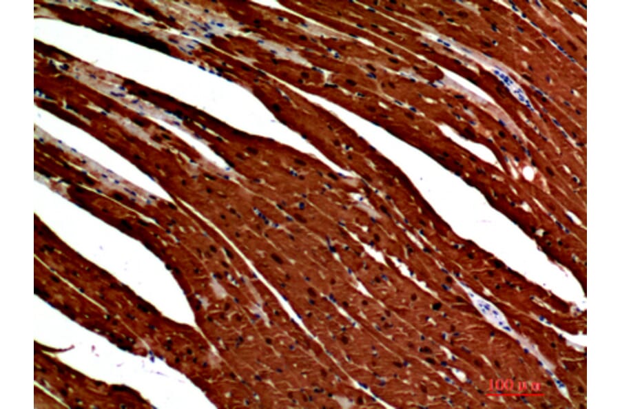 Immunohistochemistry - Anti-S100A1 Antibody (C30746) - Antibodies.com