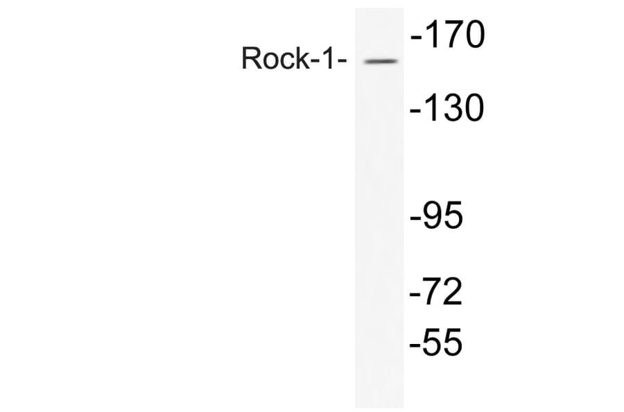 Western Blot - Anti-Rock-1 Antibody (R12-2335) - Antibodies.com