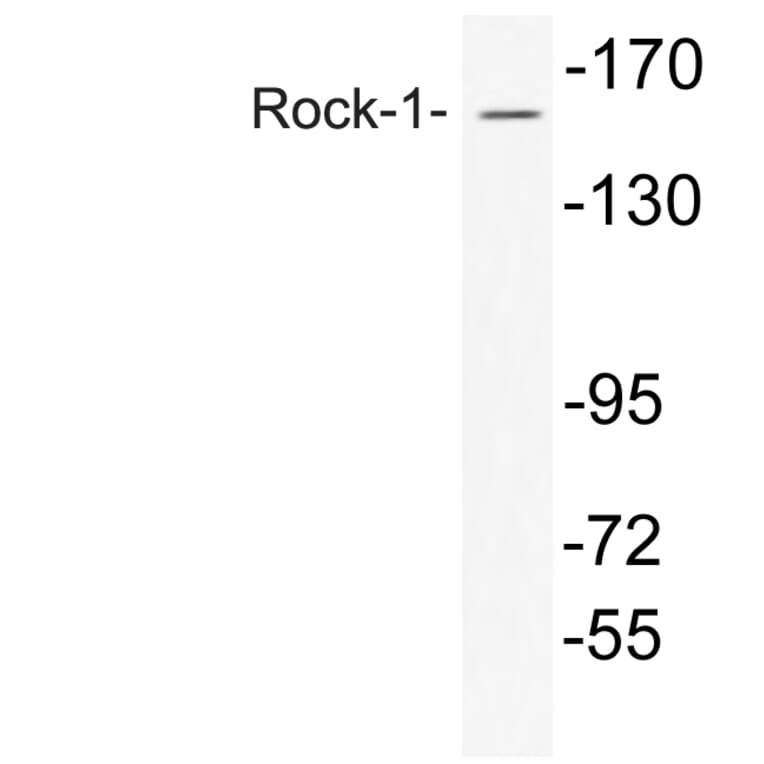 Western Blot - Anti-Rock-1 Antibody (R12-2335) - Antibodies.com
