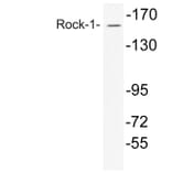 Western Blot - Anti-Rock-1 Antibody (R12-2335) - Antibodies.com