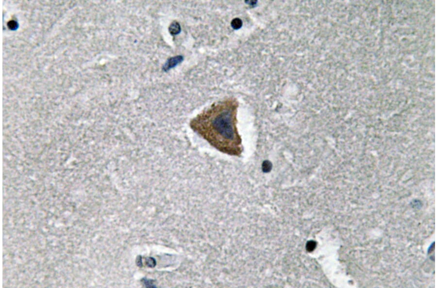 Immunohistochemistry - Anti-Rock-1 Antibody (R12-2335) - Antibodies.com