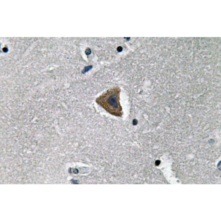 Immunohistochemistry - Anti-Rock-1 Antibody (R12-2335) - Antibodies.com