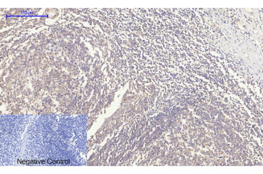 Immunohistochemistry - Anti-Rock-1 Antibody (R12-2335) - Antibodies.com