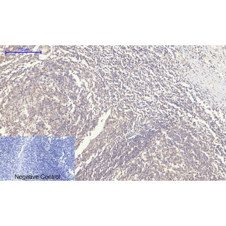 Immunohistochemistry - Anti-Rock-1 Antibody (R12-2335) - Antibodies.com