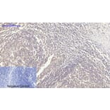 Immunohistochemistry - Anti-Rock-1 Antibody (R12-2335) - Antibodies.com