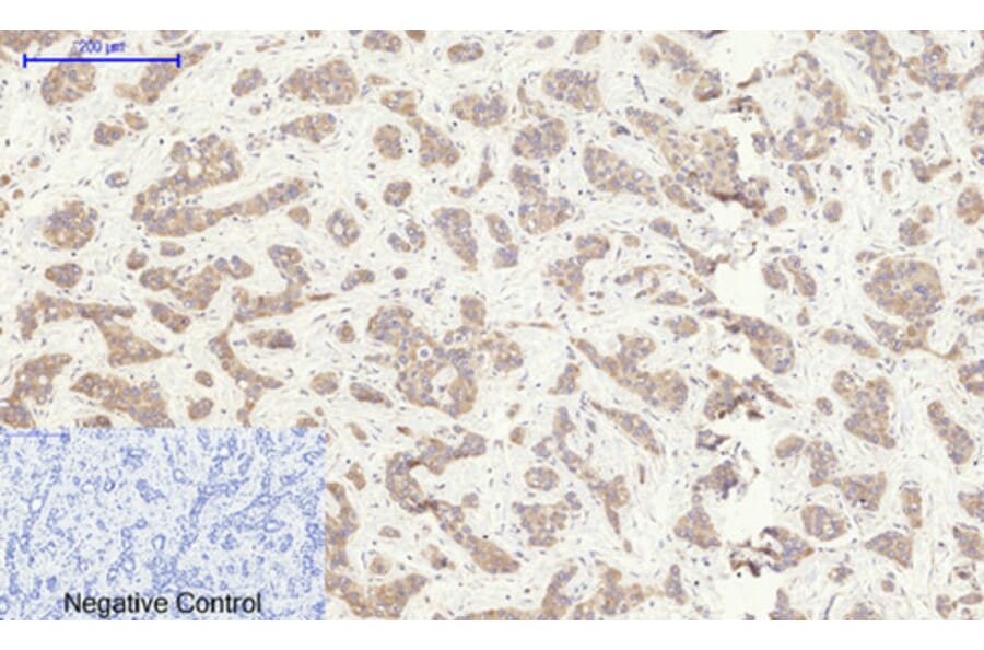 Immunohistochemistry - Anti-Rock-1 Antibody (R12-2335) - Antibodies.com