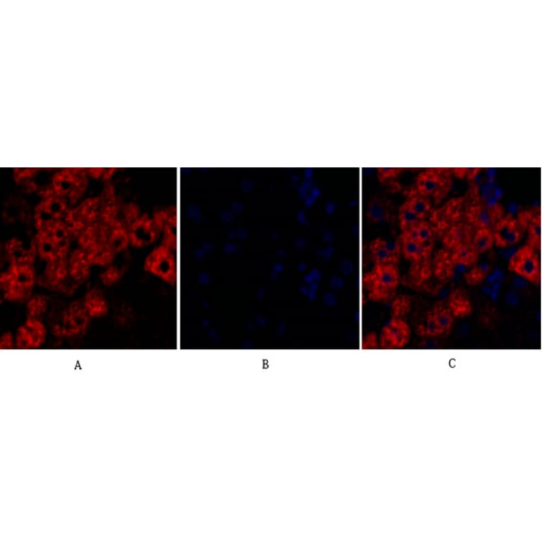 Immunofluorescence - Anti-Rock-1 Antibody (R12-2335) - Antibodies.com