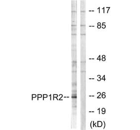 Western Blot - Anti-PPP1R2 Antibody (B1115) - Antibodies.com
