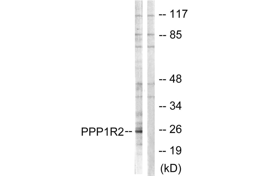 Western Blot - Anti-PPP1R2 Antibody (B1115) - Antibodies.com