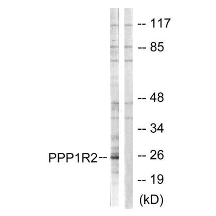 Western Blot - Anti-PPP1R2 Antibody (B1115) - Antibodies.com