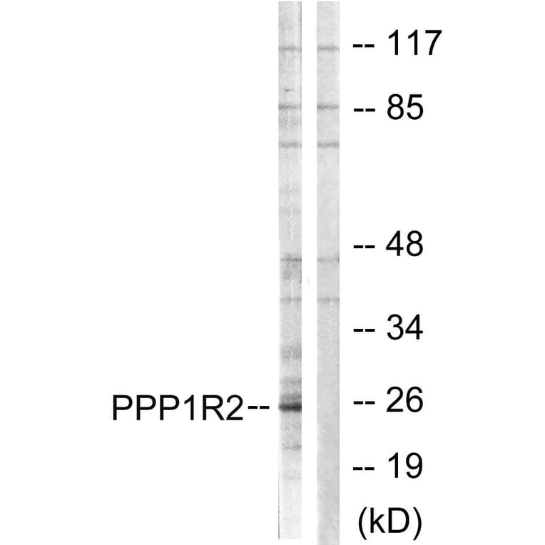 Western Blot - Anti-PPP1R2 Antibody (B1115) - Antibodies.com