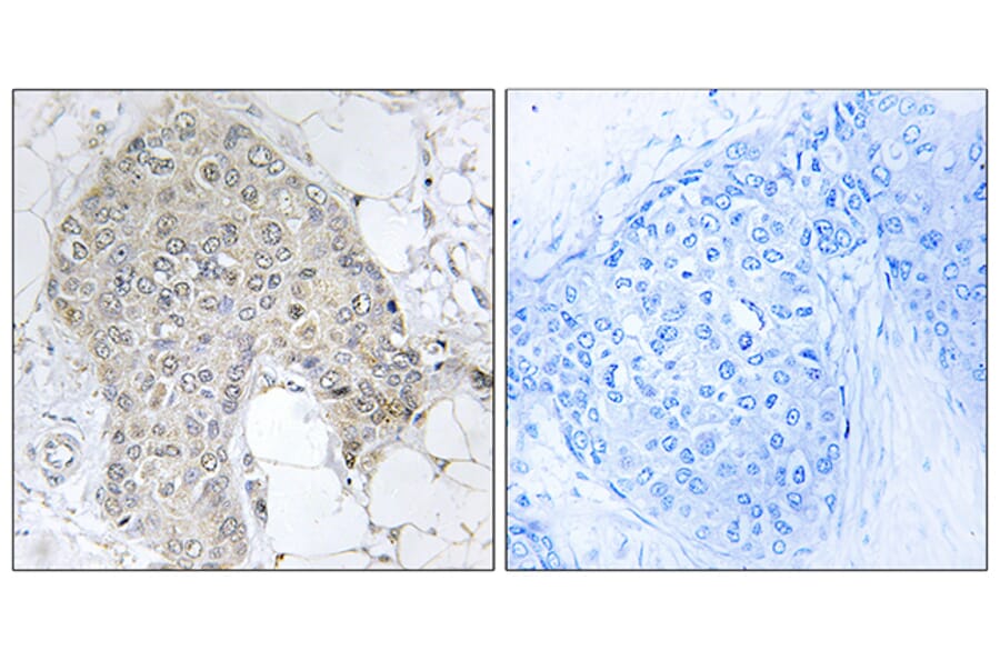 Immunohistochemistry - Anti-PPP1R2 Antibody (B1115) - Antibodies.com