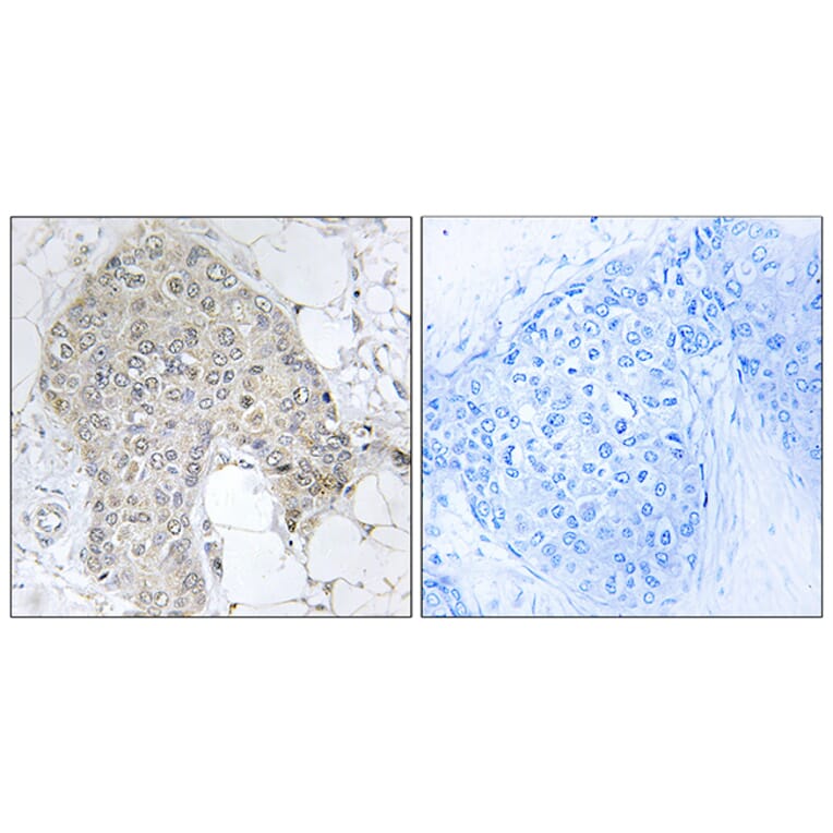 Immunohistochemistry - Anti-PPP1R2 Antibody (B1115) - Antibodies.com
