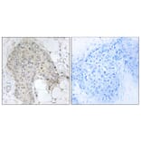 Immunohistochemistry - Anti-PPP1R2 Antibody (B1115) - Antibodies.com