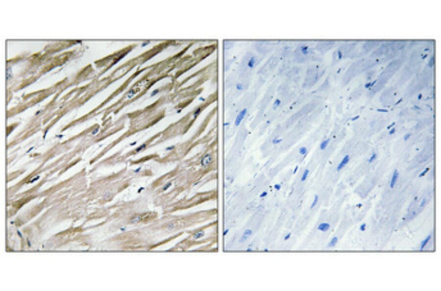Immunohistochemistry - Anti-PPP1R2 Antibody (B1115) - Antibodies.com