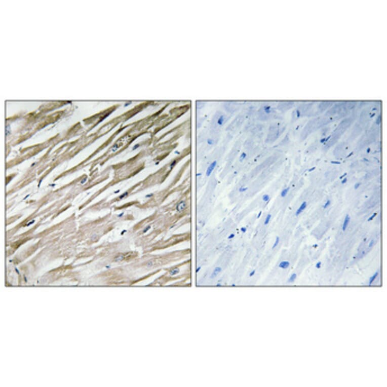 Immunohistochemistry - Anti-PPP1R2 Antibody (B1115) - Antibodies.com