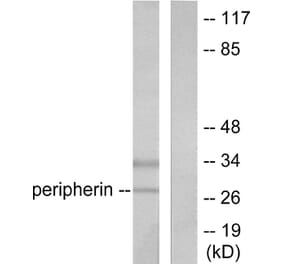 Western Blot - Anti-PGP9.5 Antibody (C0302) - Antibodies.com