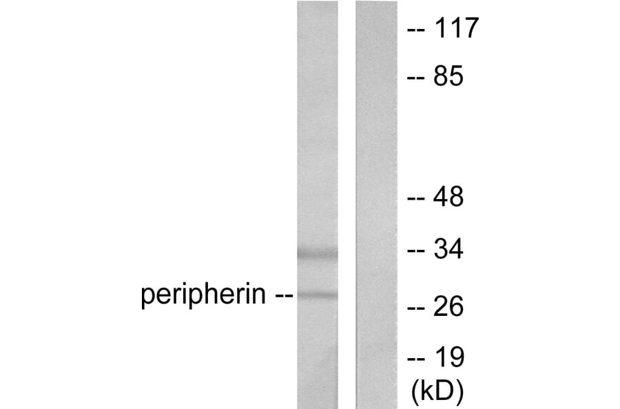 Western Blot - Anti-PGP9.5 Antibody (C0302) - Antibodies.com
