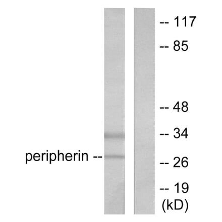 Western Blot - Anti-PGP9.5 Antibody (C0302) - Antibodies.com