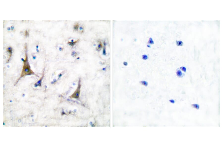 Immunohistochemistry - Anti-PGP9.5 Antibody (C0302) - Antibodies.com
