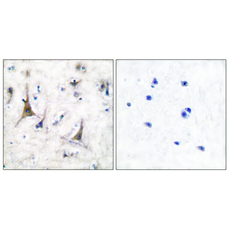 Immunohistochemistry - Anti-PGP9.5 Antibody (C0302) - Antibodies.com