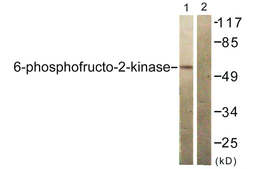 Western Blot - Anti-PFKFB2 Antibody (B0761) - Antibodies.com