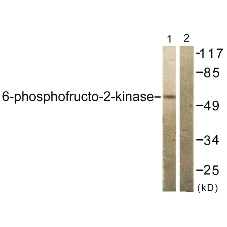 Western Blot - Anti-PFKFB2 Antibody (B0761) - Antibodies.com