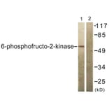 Western Blot - Anti-PFKFB2 Antibody (B0761) - Antibodies.com
