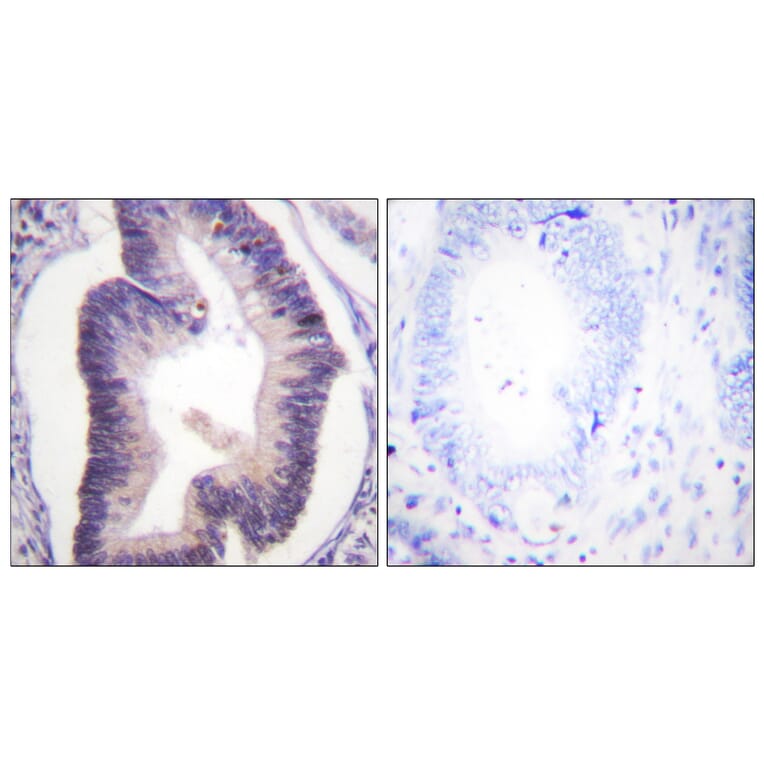 Immunohistochemistry - Anti-PFKFB2 Antibody (B0761) - Antibodies.com