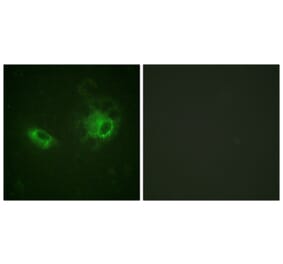 Immunofluorescence - Anti-PDGFRB Antibody (B0544) - Antibodies.com