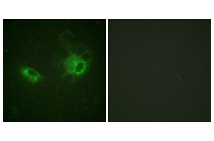 Immunofluorescence - Anti-PDGFRB Antibody (B0544) - Antibodies.com