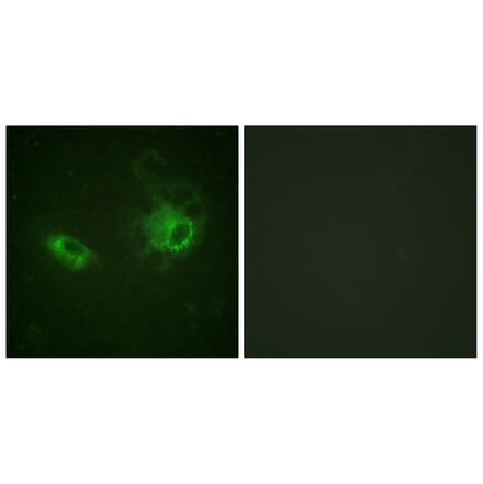Immunofluorescence - Anti-PDGFRB Antibody (B0544) - Antibodies.com