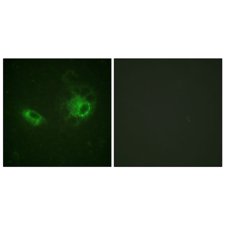 Immunofluorescence - Anti-PDGFRB Antibody (B0544) - Antibodies.com