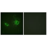 Immunofluorescence - Anti-PDGFRB Antibody (B0544) - Antibodies.com