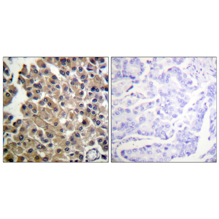 Immunohistochemistry - Anti-PDGFRB Antibody (B0544) - Antibodies.com