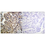 Immunohistochemistry - Anti-PDGFRB Antibody (B0544) - Antibodies.com