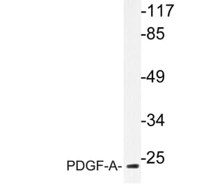 Western Blot - Anti-PDGF-A Antibody (R12-2297) - Antibodies.com