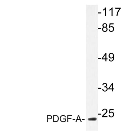 Western Blot - Anti-PDGF-A Antibody (R12-2297) - Antibodies.com