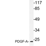 Western Blot - Anti-PDGF-A Antibody (R12-2297) - Antibodies.com